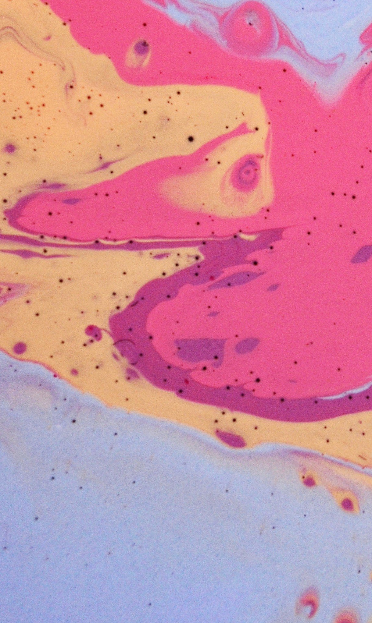 "Рыбьи глаза" (светлые пятна с точкой внутри)